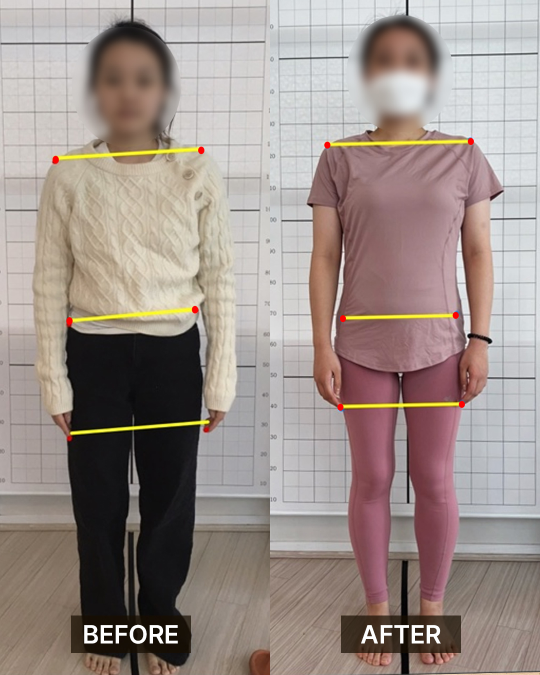 가꿈 필라테스 변화 사례
