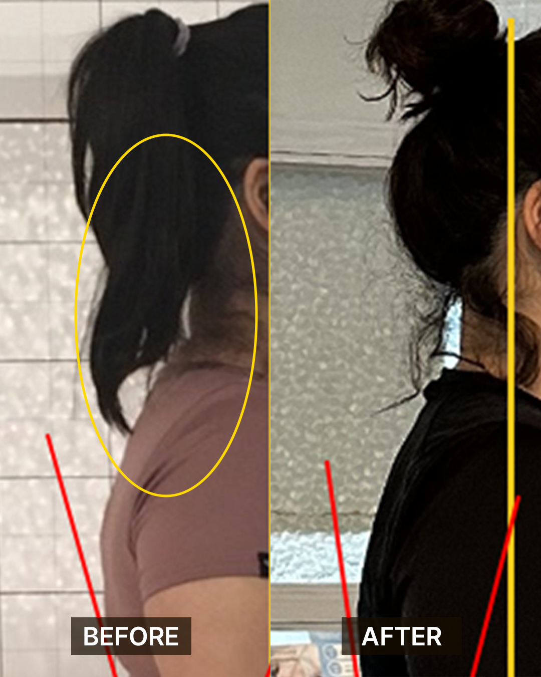 가꿈 필라테스 변화 사례
